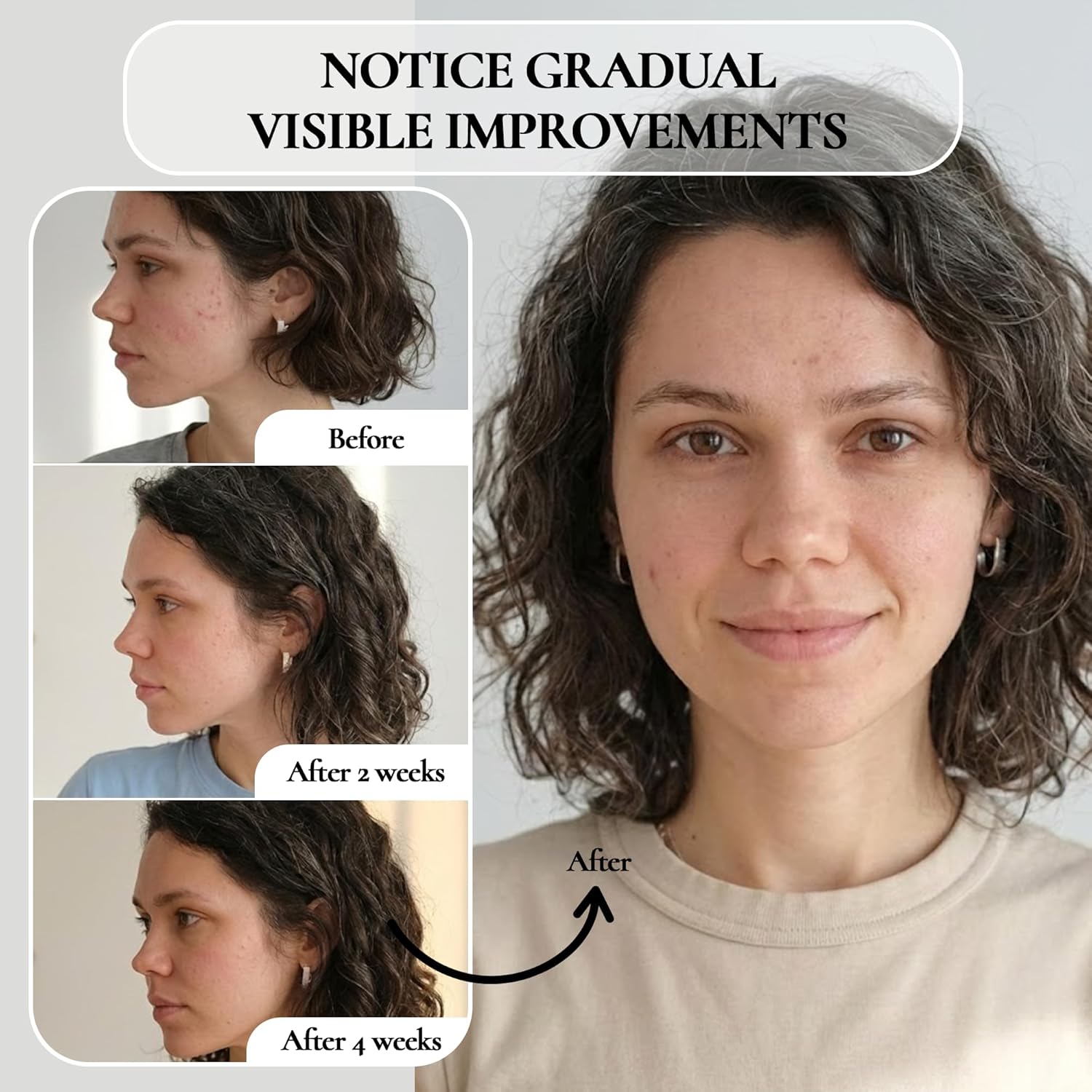 Vivo Per Lei Facial Peeling Gel Tube - Gentle Exfoliating Gel for Face - 4.05 Fl Oz - Pack of 4