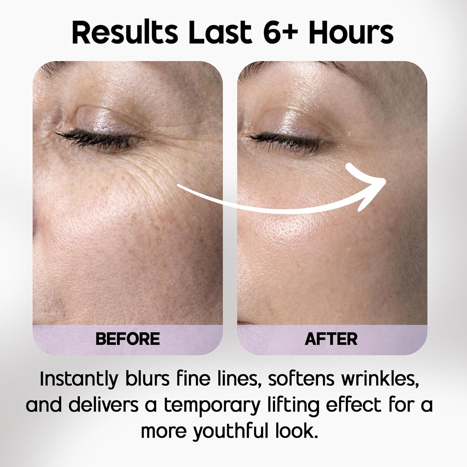Venofye Blossom Bee Advanced Wrinkle Corrector