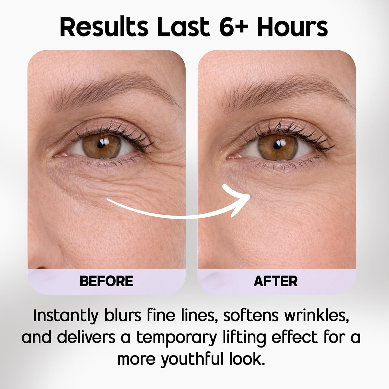 Venofye Blossom Bee Advanced Wrinkle Corrector