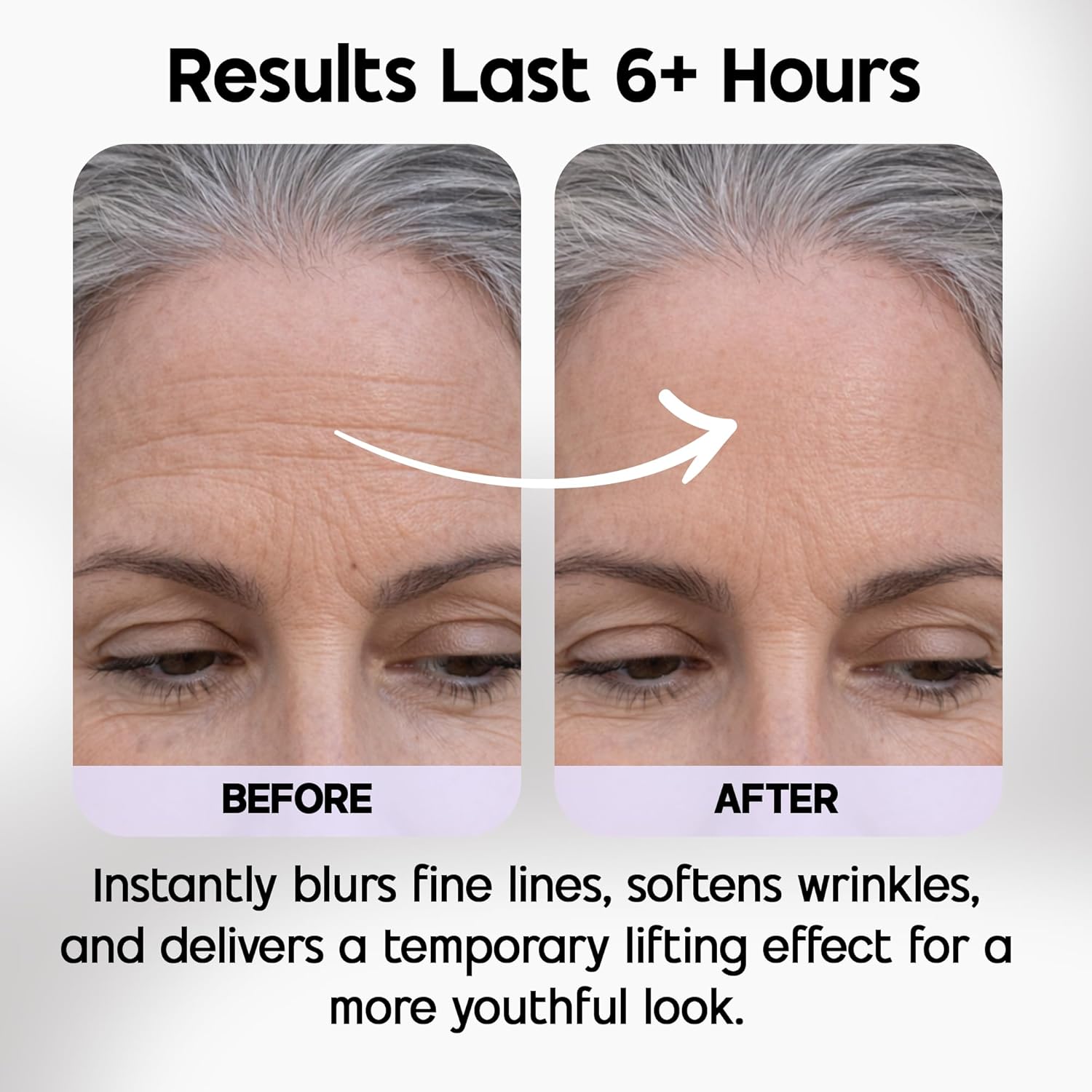 Venofye Blossom Bee Advanced Wrinkle Corrector