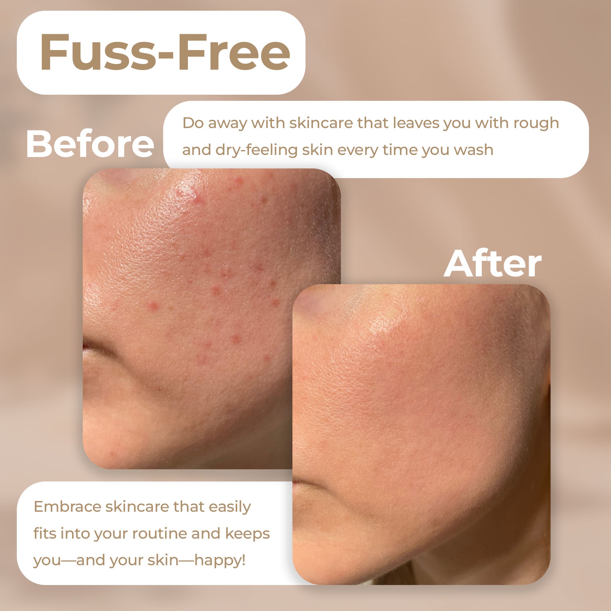 Vivo Per Lei Facial Peeling Gel Tube - Face Peel with Dead Sea Minerals - Exfoliating Gel for Cleansing - Gentle Facial Scrub - 2 Pack